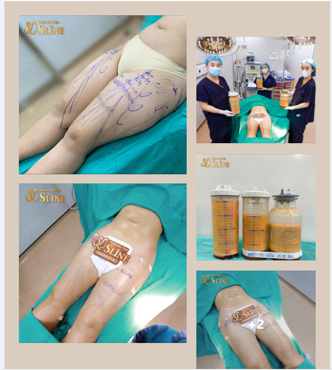 TEAM “ĐÙI ẾCH” PHẢI XIN THUA !