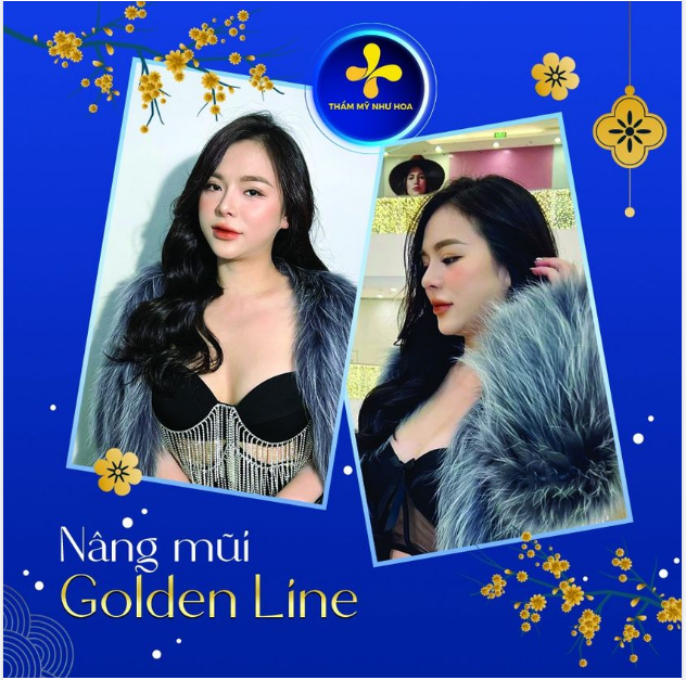 Nâng mũi thôi, ngại ngần chi