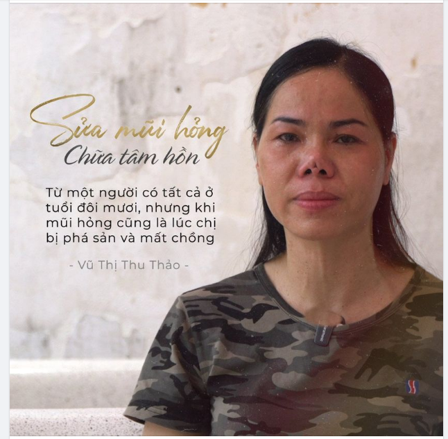 “Từ một người có tất cả ở tuổi đôi mươi, nhưng khi mũi hỏng cũng là lúc chị bị phá sản và mất chồng…” – Vũ Thị Thu Thảo