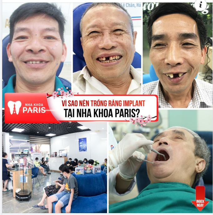 5 LÍ DO NÊN TRỒNG RĂNG TẠI VIỆN TRỒNG RĂNG IMPLANT PARIS