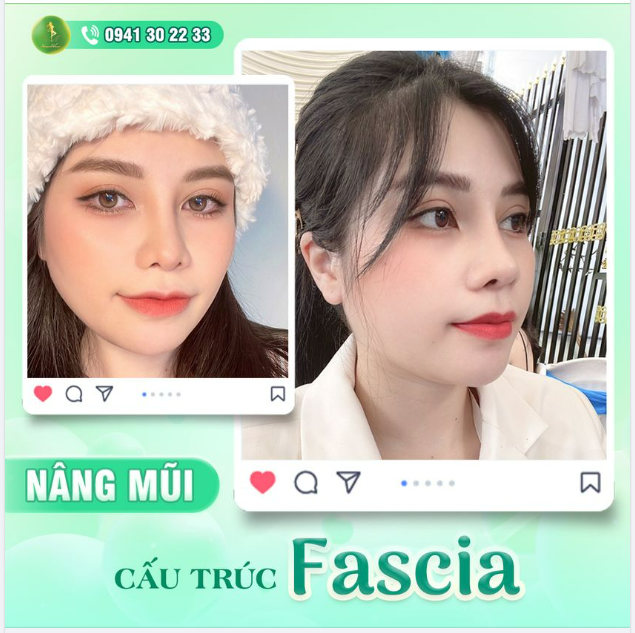 CHÌA KHÓA GIÚP KHÁCH HÀNG SỞ HỮU NHAN SẮC THĂNG HẠNG
