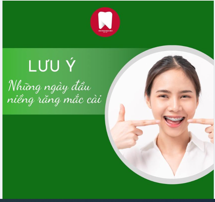 NÂNG NIU RĂNG NHỮNG NGÀY ĐẦU GẮN MẮC CÀI