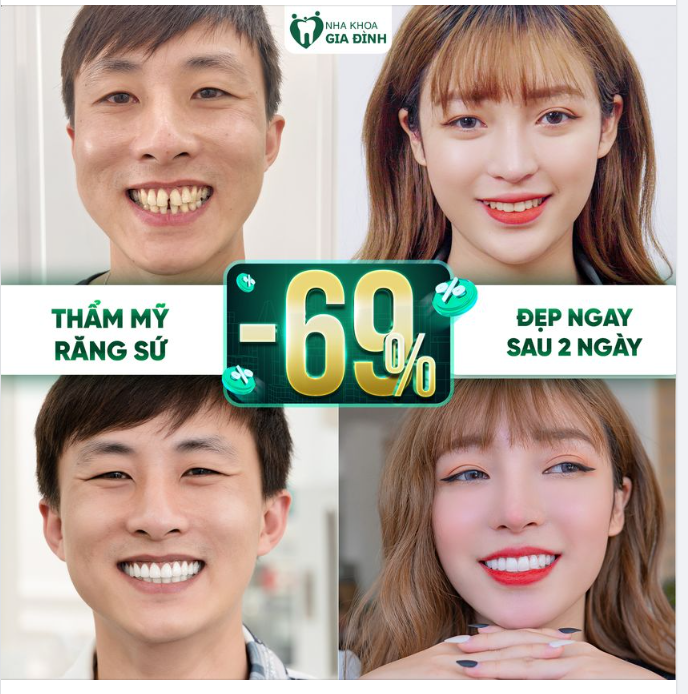 THẨM MỸ RĂNG SỨ VỚI CHUYÊN GIA 17 NĂM KINH NGHIỆM II ĐẸP NGAY SAU 2 NGÀY