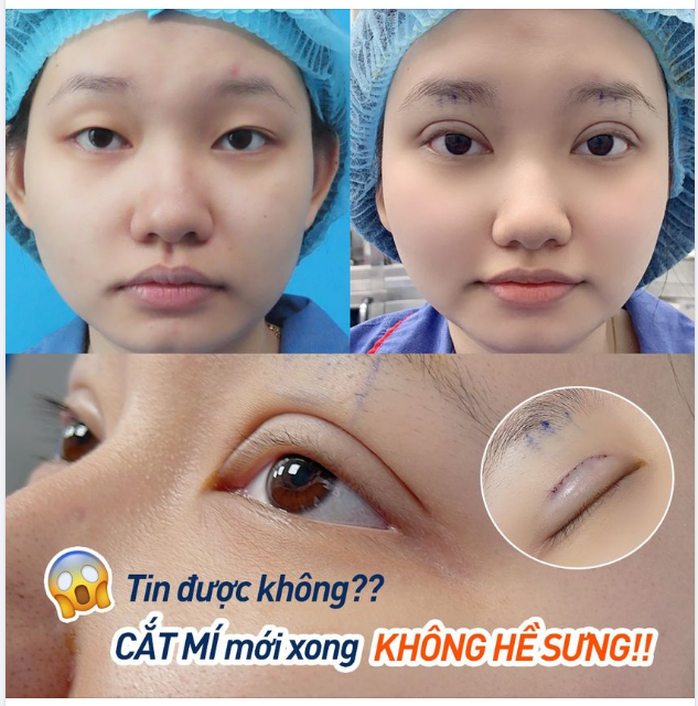 Không photoshop, không app, không fake!!