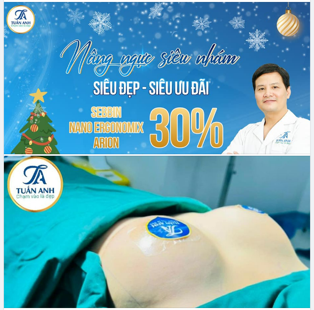 NÂNG CẤP V1 SIÊU NHÁM SIÊU ƯU ĐÃI