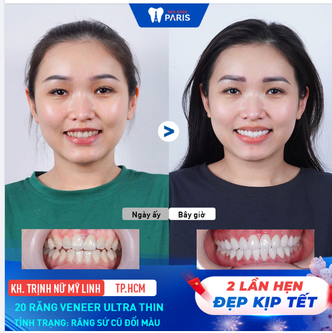 THAY RĂNG ĐỔI VẬN - ĐÓN TẾT NHƯ Ý