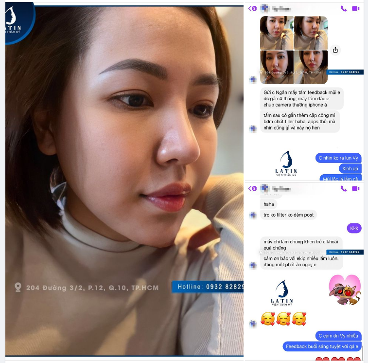 Một chiếc feedback mũi cấu trúc cho ngày cuối tuần!