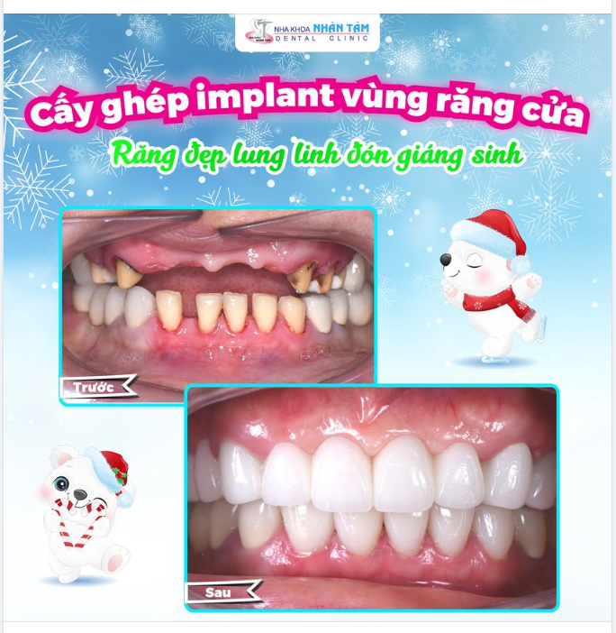 Không khí Giáng sinh đang gõ cửa, bạn đã chuẩn bị gì chưa?