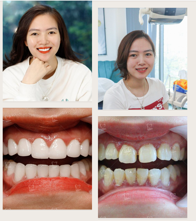Một nụ cười say đắm Hai nụ cười đắm say
