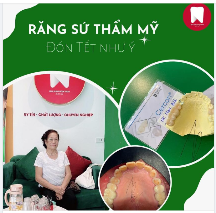 LÀM RĂNG THẨM MỸ - ĐÓN TẾT NHƯ Ý