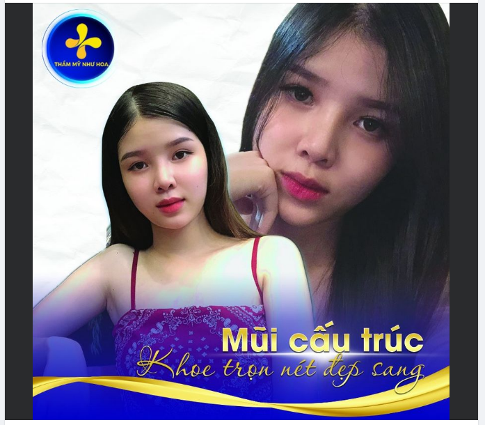 Với mong muốn: - Chỉnh sửa tất cả các khuyết điểm của mũi - Kiến tạo dáng mũi đẹp như ý - Tạo độ bền vĩnh viễn