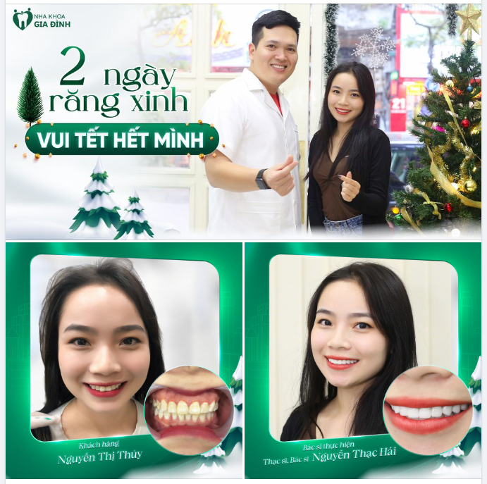 NOEL TRĂN TRỞ VÌ KHÔNG CÓ RĂNG XINH HẸN HÒ THÌ HÃY ĐẾN NGAY VỚI NHA KHOA GIA ĐÌNH