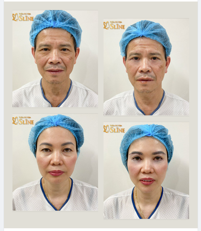 "Cùng nhau già đi" Từng làm châm ngôn sống của mọi cặp vợ chồng.. VẬY "cùng nhau đẹp hơn thì sao?