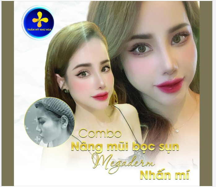 Nếu đôi mắt là cửa sổ của tâm hồn thì chiếc mũi là trung tâm của khuôn mặt, mắt đẹp rồi thì mũi cũng phải xinh mới hút trọn ánh nhìn!