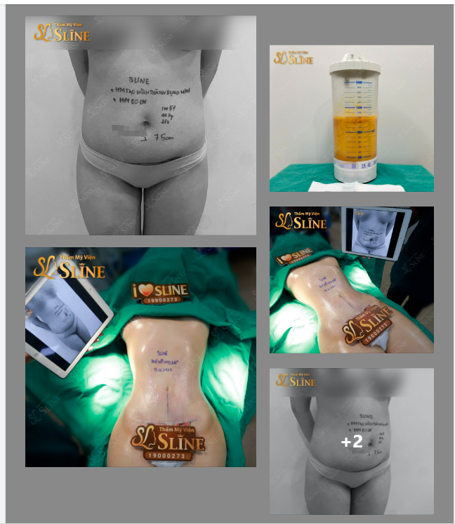 TỪ EO BÁNH MÌ HÓA BODY ĐỒNG HỒ CÁT !