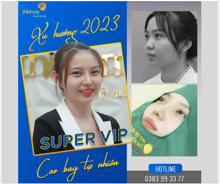Xu hướng làm đẹp 2023 - Dáng mũi Cao bay tự nhiên