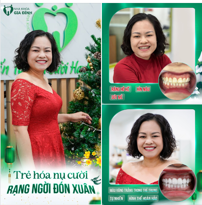 NỤ CƯỜI HẠNH PHÚC - MÓN QUÀ ĐẦY Ý NGHĨA NGÀY GIÁNG SINH