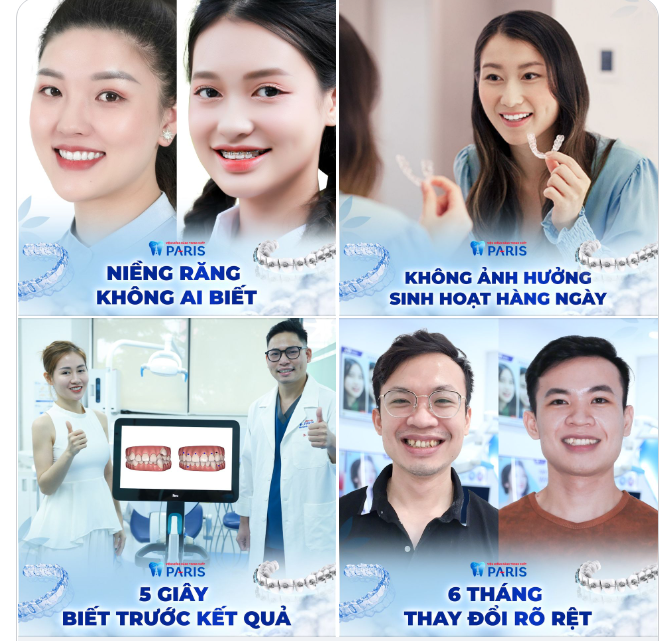 Niềng răng mà vẫn tự tin diện Tết, thoải mái ăn ngon