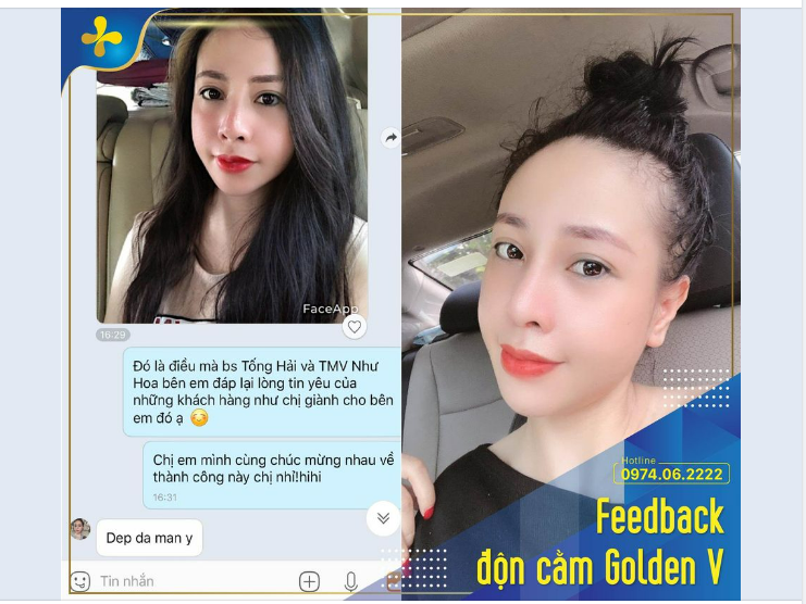 NHAN SẮC RẠNG NGỜI XINH ĐẸP SAU 1 THÁNG ĐỘN CẰM
