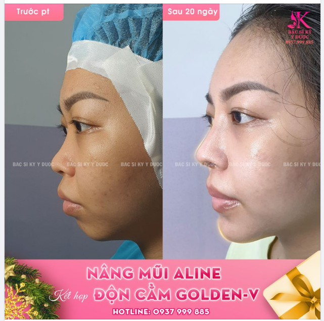 Combo CHƠI TẾT siêu xinh