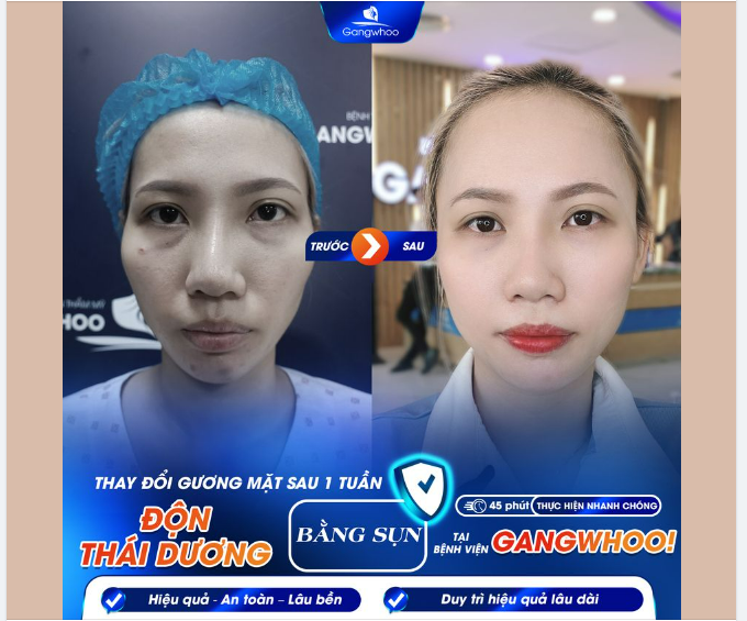 ĐỘN THÁI DƯƠNG THAY ĐỔI BẠN NHƯ THẾ NÀO?