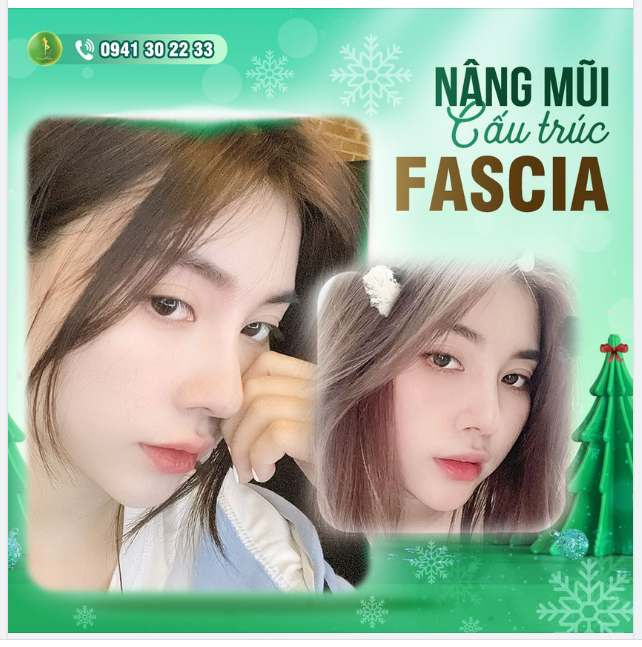 NGỌC NHI KHOE GÓC NGHIÊNG CHUẨN TỶ LỆ VÀNG
