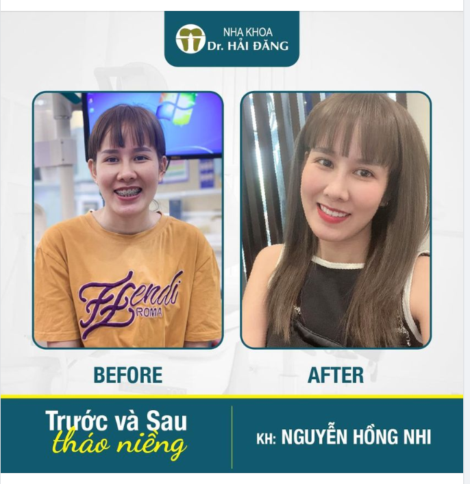 ĐẦU TƯ SINH LỜI CHO NỤ CƯỜI RẠNG RỠ