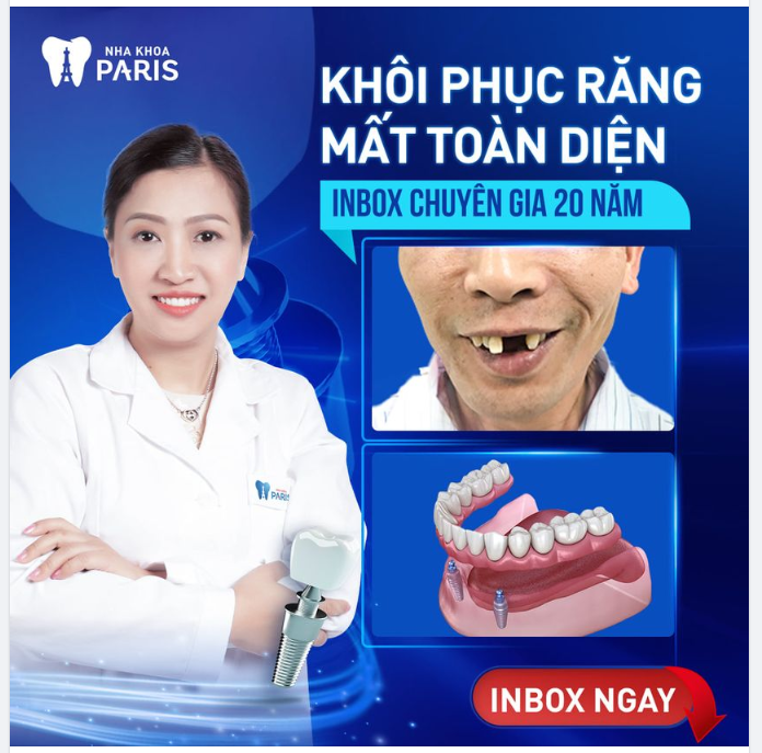 KHÔI PHỤC RĂNG MẤT CÙNG CHUYÊN GIA 20 NĂM KINH NGHIỆM
