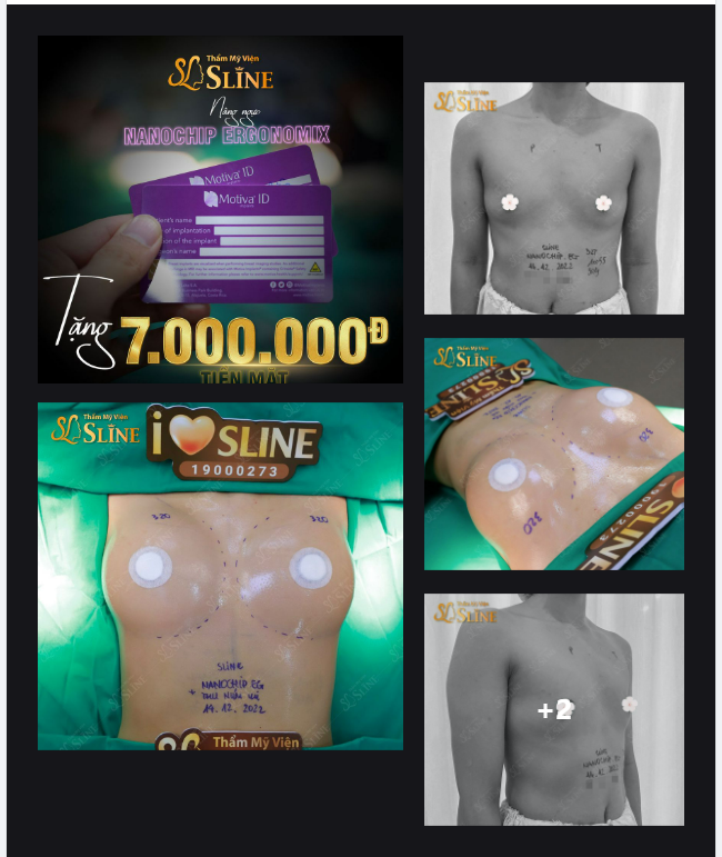 ​​​​​​​ Kết quả sau hơn 1 giờ đồng hồ khiến chị em ai cũng muốn chạy ngay tới Sline để đăng ký nâng ngực.
