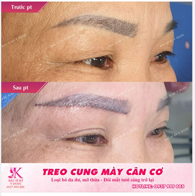 Cách nhanh nhất để lấy lại Tuổi xuân ???