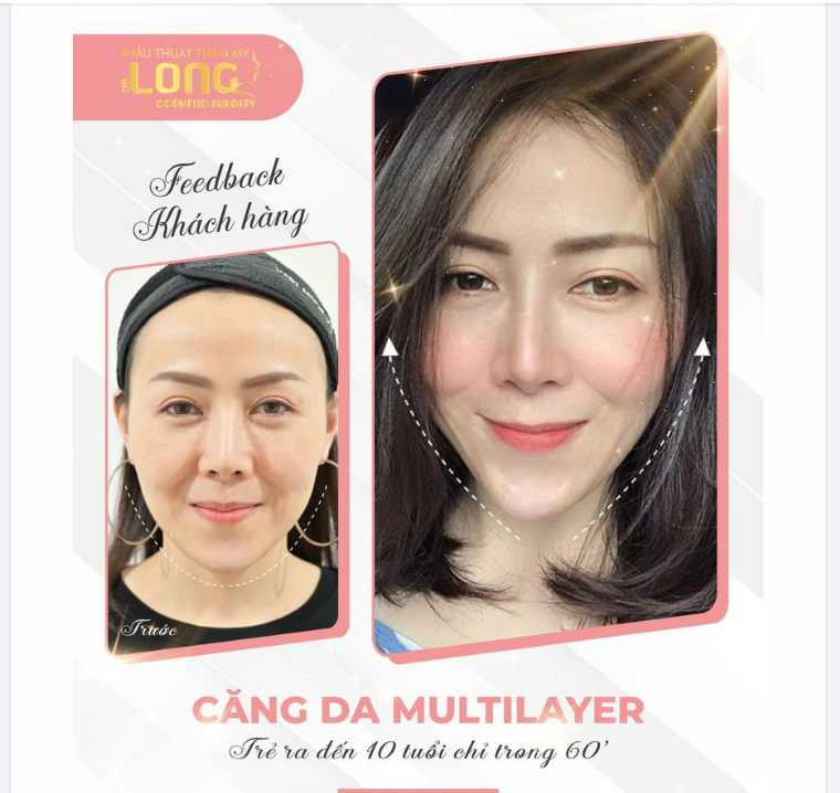 CUỘC CÁCH MẠNG CHO LÀN DA - KHỎE ĐẸP TỪ TRONG RA NGOÀI.
