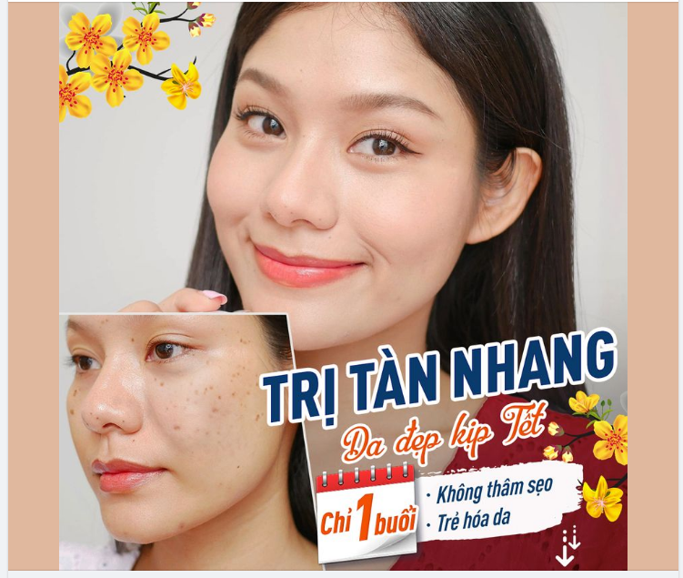 Tiệc cuối năm được làn da này thì mê mẩn