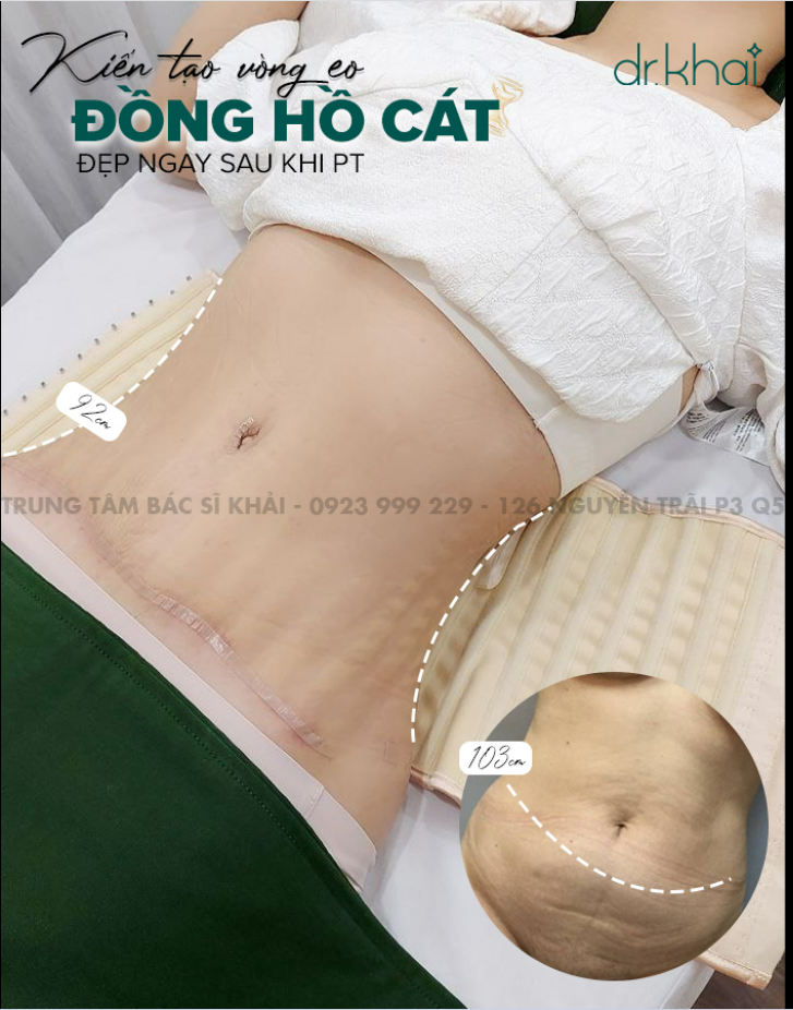 TẤM ẢNH MANG TÊN "KHỞI ĐẦU MỚI" KIẾN TẠO VÒNG EO CHUẨN ĐỒNG HỒ CÁT CHO BẠN KHÁCH HÀNG ĐẾN TỪ BÌNH DƯƠNG