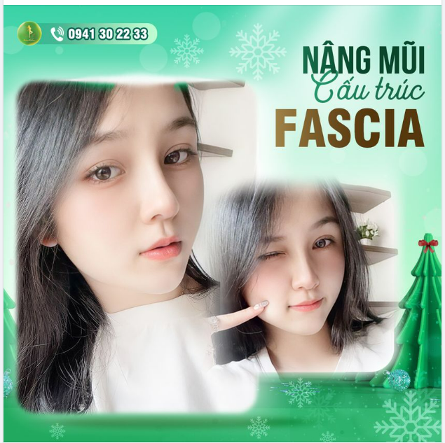TRẢ LẠI TỶ LỆ VÀNG CHO CÔ NÀNG HOT GIRL MỸ ANH