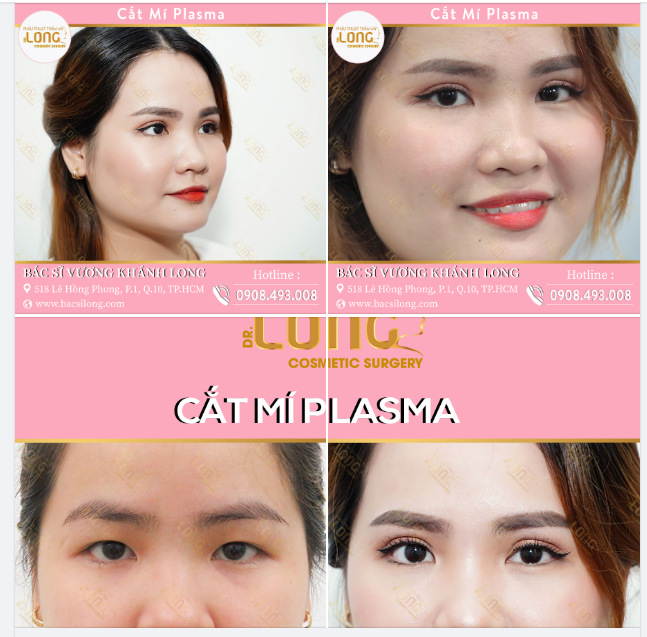 MẤY BÀ NÀO GIỜ CÒN DÀNH CẢ THANH XUÂN ĐỂ “KÍCH MÍ”