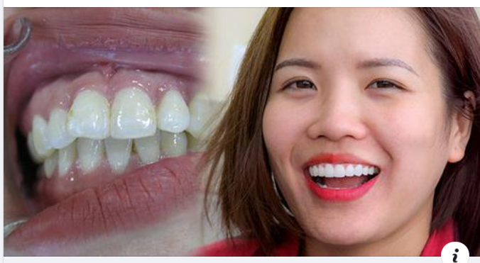 Khác biệt giữa nam giới và nữ giới trong việc chăm sóc sức khỏe răng miệng