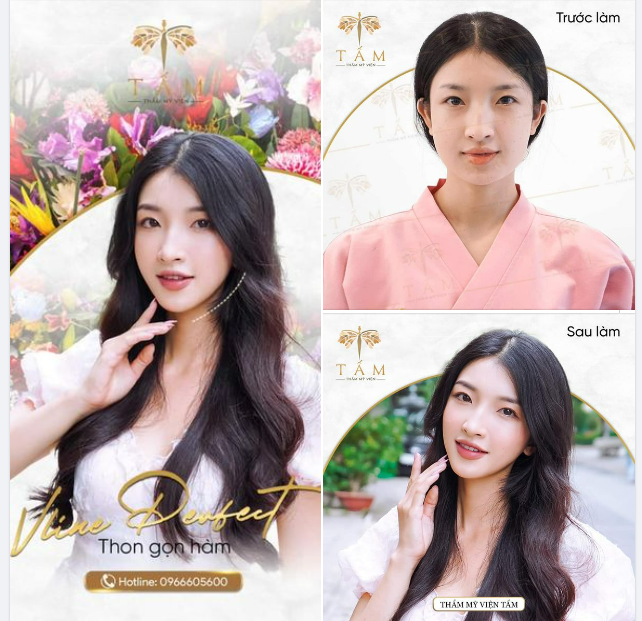 Đẹp không góc chết - Thần thái tựa nàng thơ