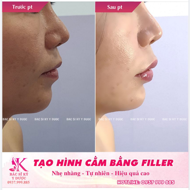Bí quyết có chiếc cằm đẹp 