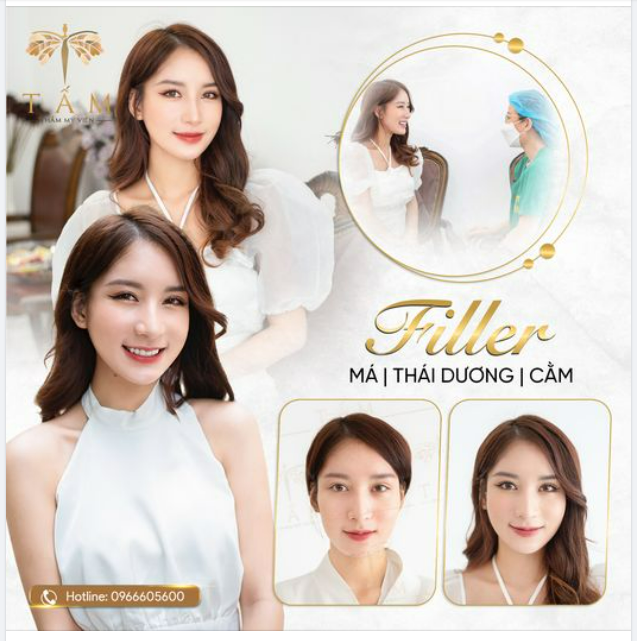 Combo Filler Má - Cằm - Thái Dương giúp bạn sở hữu gương mặt hài hòa, chuẩn sang đón Tết