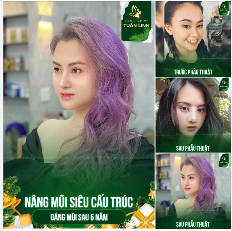 Cơ hội sở hữu gương mặt chuẩn tỉ lệ vàng với chương trình KHUYẾN MÃI nâng mũi tặng độn cằm đang diễn ra tại Tuấn Linh.
