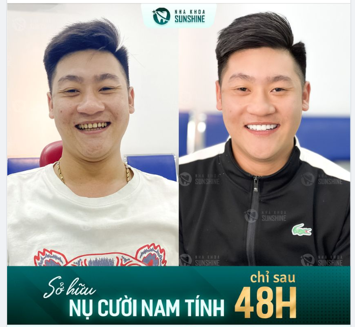 CÒN 22 NGÀY NỮA ĐẾN NOEL