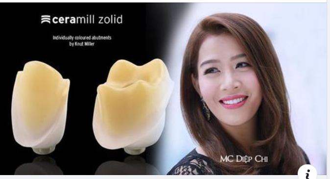Các loại răng sứ hiện nay