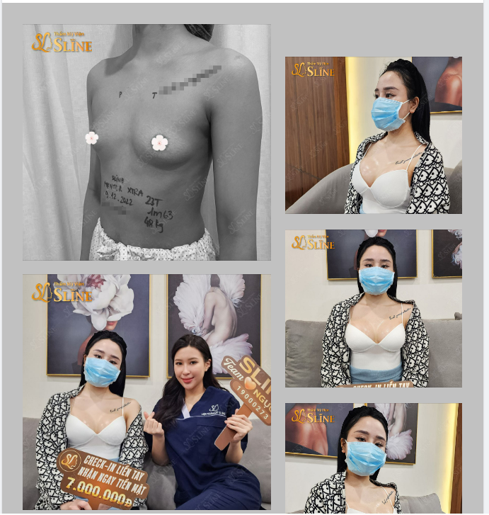 NGỰC MENTOR MEMORYGEL XTRA "6 NGÀY"