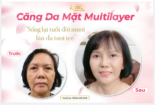 DUY TRÌ VẺ ĐẸP LÀN DA VỚI CÔNG NGHỆ ĐỘC QUYỀN