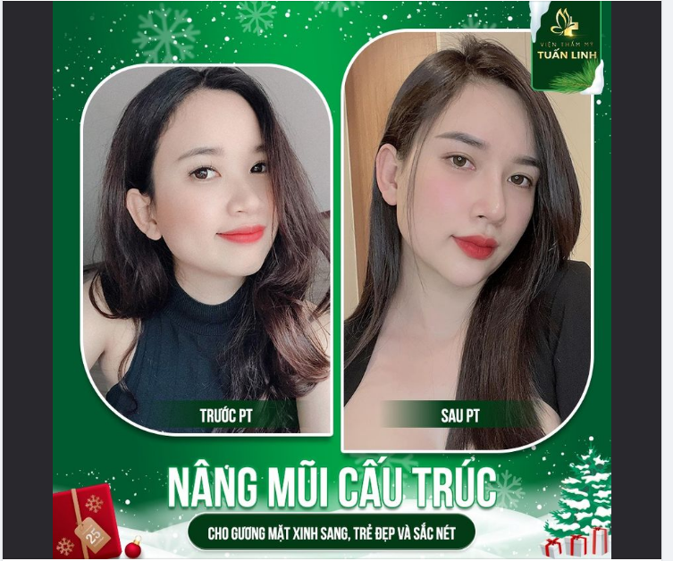 NGƯỜI ĐẸP VÌ LỤA - MŨI ĐẸP NHỜ TUẤN LINH.
