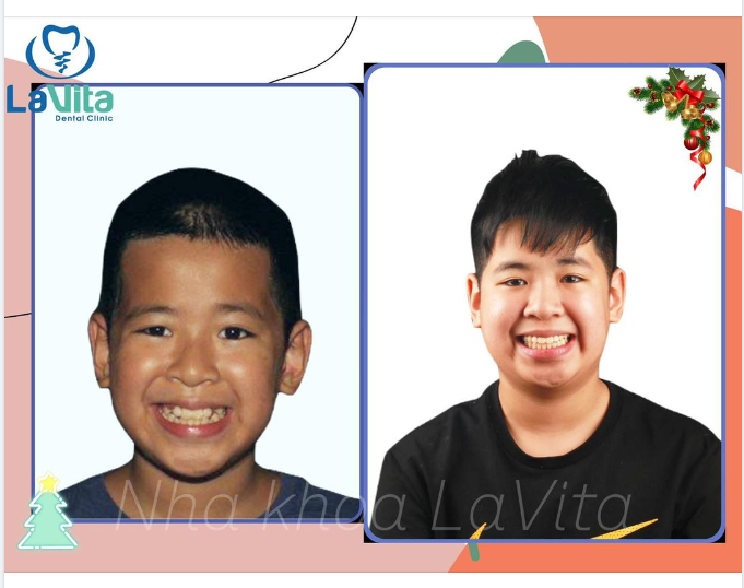 Hạnh phúc lớn nhất đối với các bác sĩ của Nha khoa Lavita là gì?