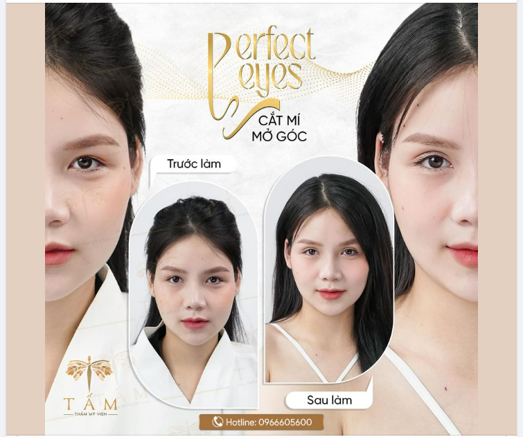 Sự khác biệt rõ rệt trước và ngay sau làm, đến TMV Tấm bạn sẽ được: