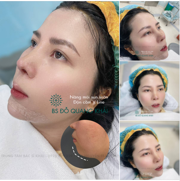 TẬU DÁNG CẰM THON - TẾT RƯỚC LỘC TO