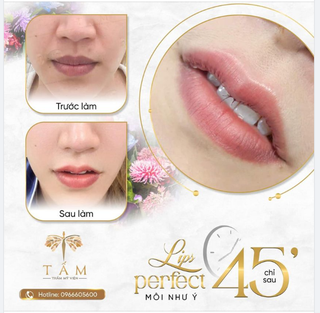 MÔI XINH THÁCH THỨC MỌI ÁNH NHÌN