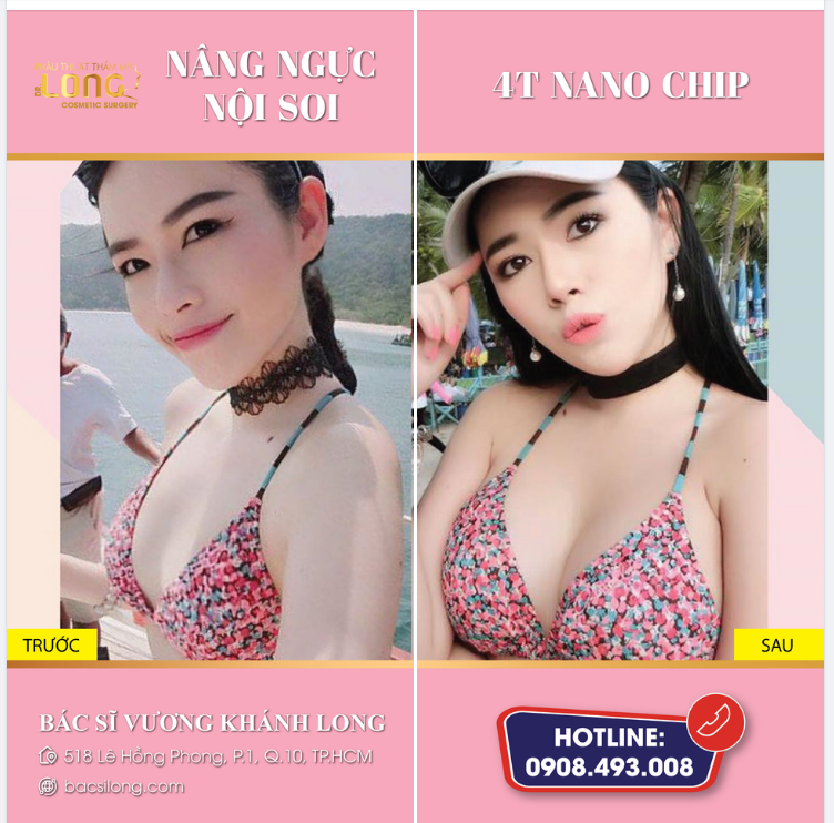 VÒNG 1 THẦN TỐC - XINH ĐẸP TRONG PHÚT CHỐC